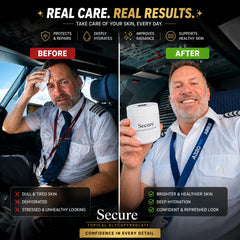 Secure® – Stop Excessive Sweating. Start Living Confidently